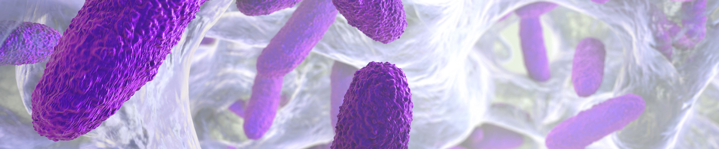 BlogHeroBanner_Managing and Preventing Biofilms