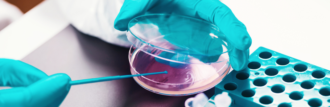 campylobacter sampling EU