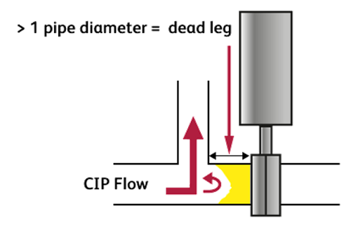 Dead leg illustration