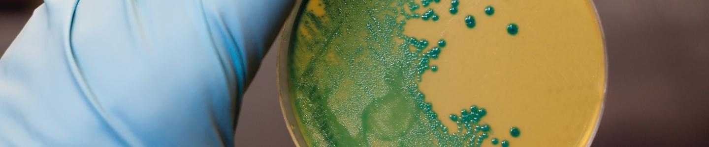 listeria management in processing plants